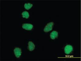 Anti-ATR Mouse Monoclonal Antibody [clone: 3F2]