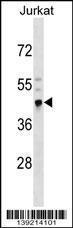 Anti-CRELD2 Rabbit Polyclonal Antibody (HRP (Horseradish Peroxidase))