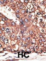 Anti-LEPR Rabbit Polyclonal Antibody (PE (Phycoerythrin))