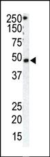 Anti-GRK1 Rabbit Polyclonal Antibody