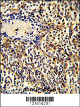 Anti-CCL3 Rabbit Polyclonal Antibody