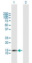 Anti-CDKN2C Mouse Polyclonal Antibody