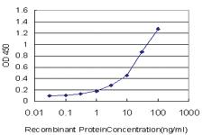 Anti-ITGA2 Mouse Monoclonal Antibody [clone: 2B6]