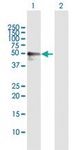 Anti-CALCOCO2 Rabbit Polyclonal Antibody