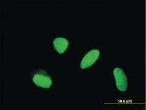 Anti-KLHDC4 Mouse Monoclonal Antibody [clone: 4G11]