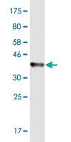 Anti-RHOT1 Mouse Monoclonal Antibody [clone: 1A12]