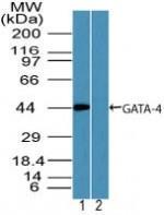 Anti-GATA4 Rabbit Polyclonal Antibody