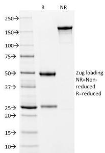 SDS-PAGE analysis of Anti-Cytokeratin 10 Antibody [LH2] under non-reduced and reduced conditions; showing intact IgG and intact heavy and light chains, respectively. SDS-PAGE analysis confirms the integrity and purity of the antibody