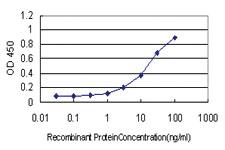 Anti-ATR Mouse Monoclonal Antibody [clone: 3F2]