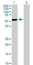 Anti-MAPKAPK5 Rabbit Polyclonal Antibody