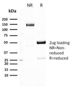 SDS-PAGE analysis of Anti-GLUT1 Antibody [GLUT1/3132R] under non-reduced and reduced conditions; showing intact IgG and intact heavy and light chains, respectively. SDS-PAGE analysis confirms the integrity and purity of the antibody.