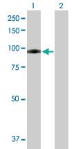 Anti-PLG Mouse Polyclonal Antibody