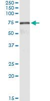 Anti-CES2 Polyclonal Antibody Pair