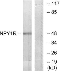 Anti-NPY1R antibody