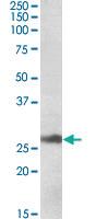 Anti-DNAJB9 Goat Polyclonal Antibody