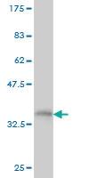 Anti-RNF141 Mouse Monoclonal Antibody [clone: 6D9]