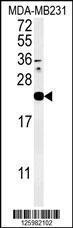 Anti-IL36A Rabbit Polyclonal Antibody (FITC (Fluorescein Isothiocyanate))