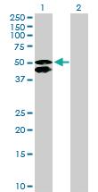 Anti-CALCOCO2 Rabbit Polyclonal Antibody