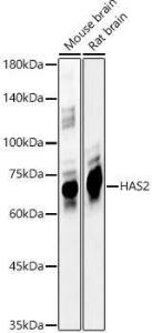 Western blot analysis of various lysates, using Anti-Hyaluronan synthase 2 Antibody (A12414) at 1:500 dilution