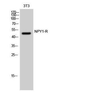 Anti-NPY1R antibody