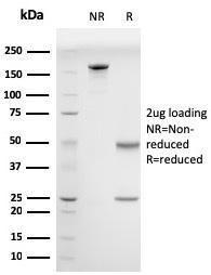 SDS-PAGE analysis of Anti-Drebrin Antibody [DBN1/2880] under non-reduced and reduced conditions; showing intact IgG and intact heavy and light chains, respectively. SDS-PAGE analysis confirms the integrity and purity of the antibody.