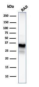 Anti-CD20 antibody