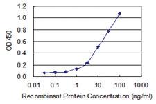 Anti-KLHDC4 Mouse Monoclonal Antibody [clone: 4G11]