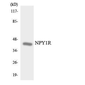 Anti-NPY1R antibody