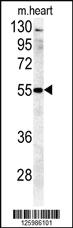 Anti-B4GALT5 Rabbit Polyclonal Antibody