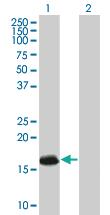 Anti-ATRX Mouse Polyclonal Antibody