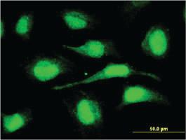 Anti-ORC6 Mouse Monoclonal Antibody [clone: 3C4]