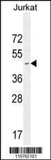 Anti-CD34 Rabbit Polyclonal Antibody (AP (Alkaline Phosphatase))