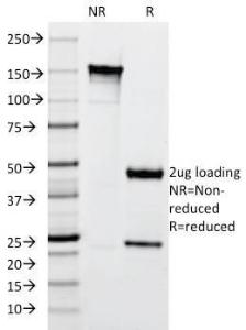 SDS-PAGE analysis of Anti-Cytokeratin 10 Antibody [SPM261] under non-reduced and reduced conditions; showing intact IgG and intact heavy and light chains, respectively. SDS-PAGE analysis confirms the integrity and purity of the antibody.