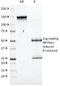 SDS-PAGE analysis of Anti-CD98 Antibody [UM7F8] under non-reduced and reduced conditions; showing intact IgG and intact heavy and light chains, respectively. SDS-PAGE analysis confirms the integrity and purity of the antibody.