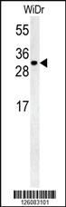 Anti-TM2D3 Rabbit Polyclonal Antibody