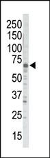 Anti-GRK5 Rabbit Polyclonal Antibody