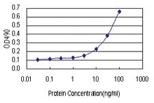 Anti-PIH1D1 Antibody Pair