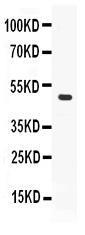 Anti-PLIN2 Rabbit Polyclonal Antibody