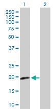 Anti-CDKN2D Rabbit Polyclonal Antibody