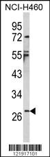 Anti-PPM1A Rabbit Polyclonal Antibody