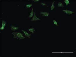 Anti-ITGA4 Mouse Monoclonal Antibody [clone: 2G10]