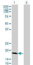 Anti-CDKN2D Mouse Monoclonal Antibody [clone: 2E10]