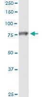 Anti-NDUFS1 Polyclonal Antibody Pair