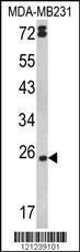 Anti-LTA Rabbit Polyclonal Antibody (HRP (Horseradish Peroxidase))