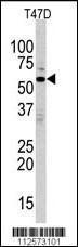 Anti-MAP Kinase 15 Rabbit Polyclonal Antibody