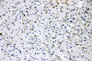 Anti-PLIN2 Rabbit Polyclonal Antibody