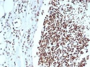 Immunohistochemical analysis of formalin-fixed, paraffin-embedded human lymph node tissue using Anti-Ku80 Antibody [XRCC5/7318]