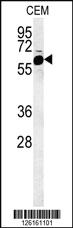 Anti-FADS2 Rabbit Polyclonal Antibody