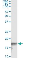 Anti-CDKN2D Mouse Monoclonal Antibody [clone: 2E10]