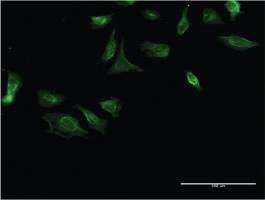 Anti-ITGA4 Mouse Monoclonal Antibody [clone: 2G10]